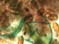 /album/galleria-foto-eubatteri/microscopia-5-jpg/